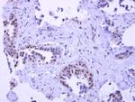 PYGO2 Antibody in Immunohistochemistry (Paraffin) (IHC (P))