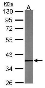 PYGO2 Antibody in Western Blot (WB)