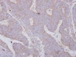 SMYD3 Antibody in Immunohistochemistry (Paraffin) (IHC (P))