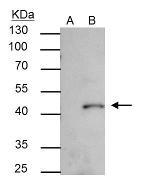 SMYD3 Antibody in Immunoprecipitation (IP)