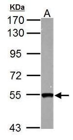 SMYD1 Antibody in Western Blot (WB)