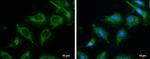 Phospho-ROCK2 (Ser1366) Antibody in Immunocytochemistry (ICC/IF)