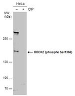 Phospho-ROCK2 (Ser1366) Antibody in Western Blot (WB)