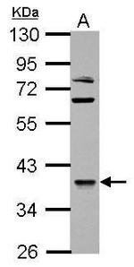 OXSM Antibody in Western Blot (WB)