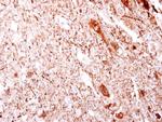 beta Dystroglycan Antibody in Immunohistochemistry (Paraffin) (IHC (P))