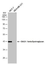 beta Dystroglycan Antibody in Western Blot (WB)