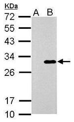 Galectin 3 Antibody in Western Blot (WB)