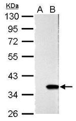 Galectin 4 Antibody in Western Blot (WB)