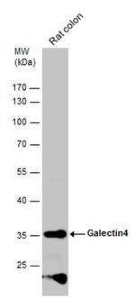 Galectin 4 Antibody in Western Blot (WB)