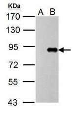 Influenza A PB1 Antibody in Western Blot (WB)