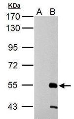 RAD26L Antibody in Western Blot (WB)