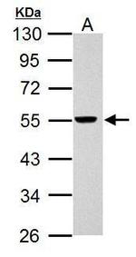 RAD26L Antibody in Western Blot (WB)