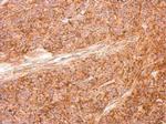 AID Antibody in Immunohistochemistry (Paraffin) (IHC (P))