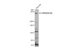 SETD2 Antibody in Western Blot (WB)