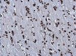 hnRNP A2B1 Antibody in Immunohistochemistry (Paraffin) (IHC (P))