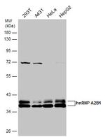 hnRNP A2B1 Antibody in Western Blot (WB)