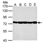 GRP78 Antibody in Western Blot (WB)