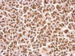 MOK Antibody in Immunohistochemistry (Paraffin) (IHC (P))