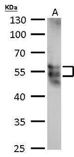 MOK Antibody in Western Blot (WB)