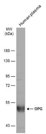 TNFRSF11B Antibody in Western Blot (WB)