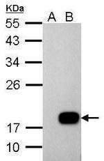 DCTD Antibody in Western Blot (WB)