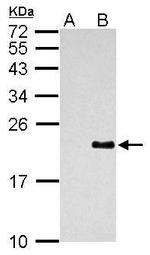 Dengue Virus Type 2 PrM Antibody in Western Blot (WB)