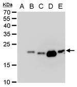 Dengue Virus Type 2 PrM Antibody in Western Blot (WB)