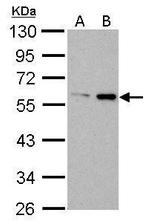 ATG14 Antibody in Western Blot (WB)