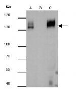 mCherry Antibody in Immunoprecipitation (IP)