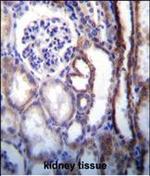 ATP6V1B1 Antibody in Immunohistochemistry (Paraffin) (IHC (P))