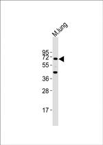 TGFBR2 Antibody in Western Blot (WB)