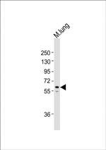 TGFBR2 Antibody in Western Blot (WB)