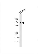 TGFBR2 Antibody in Western Blot (WB)