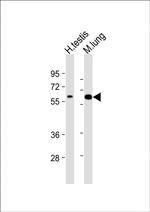 TGFBR2 Antibody in Western Blot (WB)