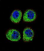 beta Arrestin 1 Antibody in Immunocytochemistry (ICC/IF)