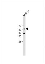 beta Arrestin 1 Antibody in Western Blot (WB)