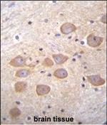 PCDH1 Antibody in Immunohistochemistry (Paraffin) (IHC (P))