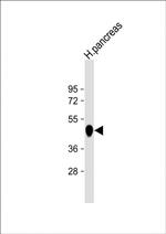 Carboxypeptidase B1 Antibody in Western Blot (WB)