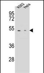 Carboxypeptidase B1 Antibody in Western Blot (WB)