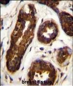 Maspin Antibody in Immunohistochemistry (Paraffin) (IHC (P))