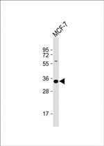 STUB1 Antibody in Western Blot (WB)