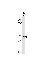 STUB1 Antibody in Western Blot (WB)