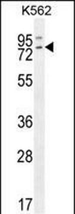 RASGRP2 Antibody in Western Blot (WB)