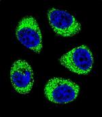 SLC25A6 Antibody in Immunocytochemistry (ICC/IF)