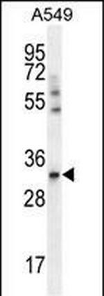 SLC25A6 Antibody in Western Blot (WB)