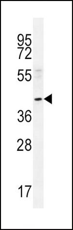 NEU2 Antibody in Western Blot (WB)