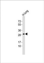 GSTT1 Antibody in Western Blot (WB)