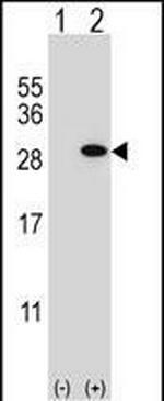 GSTT1 Antibody in Western Blot (WB)