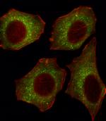 CACNA2D2 Antibody in Immunocytochemistry (ICC/IF)