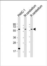 SLC11A2 Antibody in Western Blot (WB)